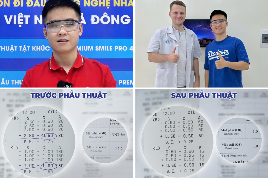 Gen Z Hải Phòng chọn phẫu thuật Super Smile Pro: Thị lực từ 0.5/10 đạt 10/10 sau phẫu thuật