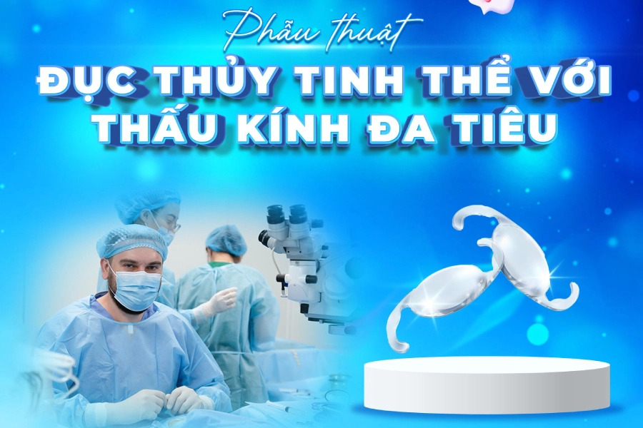 Lý do người cao tuổi nên lựa chọn thay thủy tinh thể đa tiêu