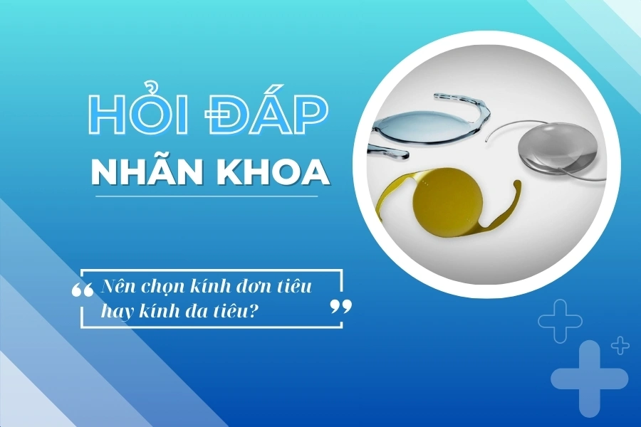 Hỏi đáp nhãn khoa: Phẫu thuật thay thủy tinh thể nên chọn kính đơn tiêu hay đa tiêu?