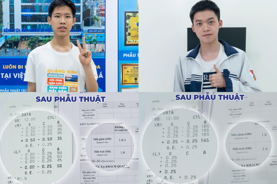 Phẫu thuật Super Smile Pro, hai nam sinh Hải Phòng đủ tiêu chuẩn thị lực thi quân đội